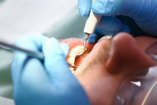 Best Broken Tooth Emergency  in Monticello, MN